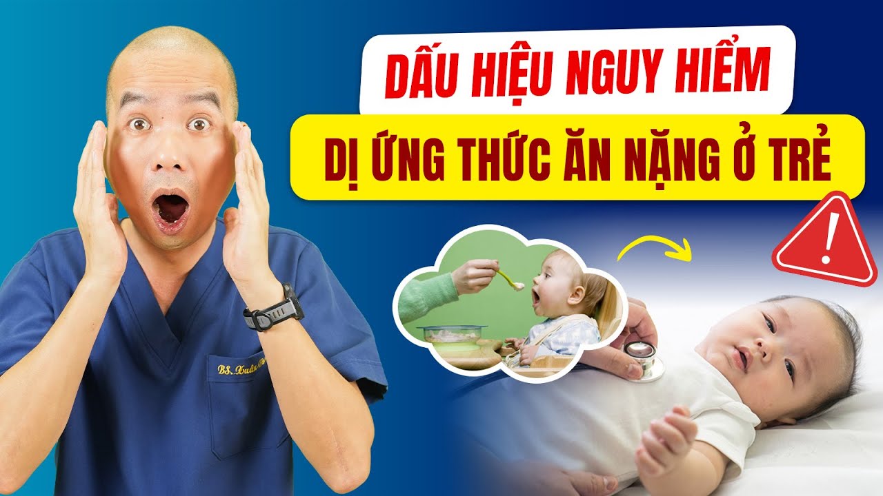 Dị ứng thức ăn ở trẻ nhỏ: 7 dấu hiệu cha mẹ phải nhận biết sớm | Bác sĩ Lê Xuân Dương