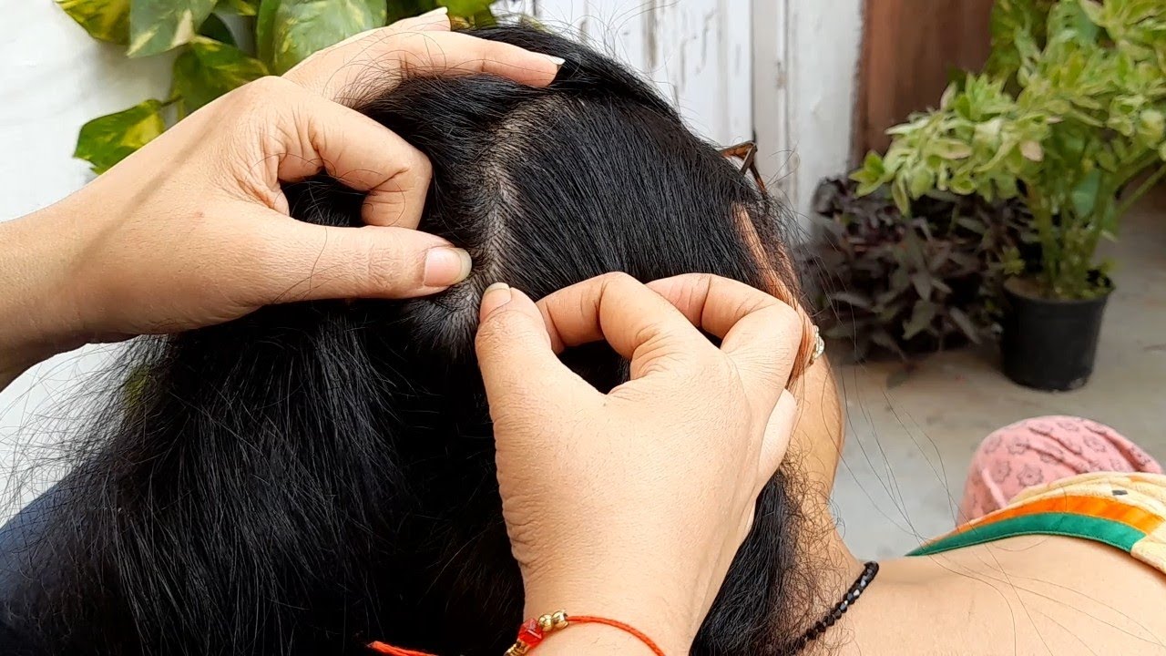 😊🌜 #carikutu #haircracking #licepicking #scalpcheck #tickremoval #whitehairremoval #cornbraiding