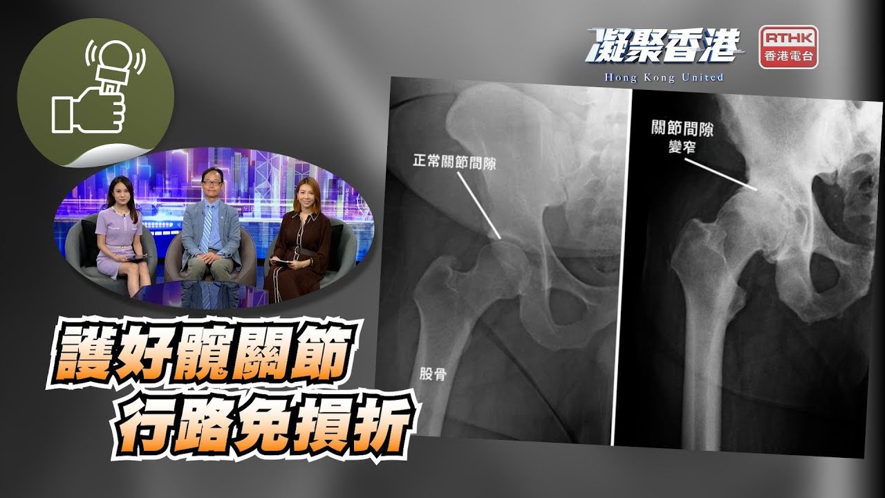 凝聚香港：第833集 髖關節炎影響行動，有何解決良方？