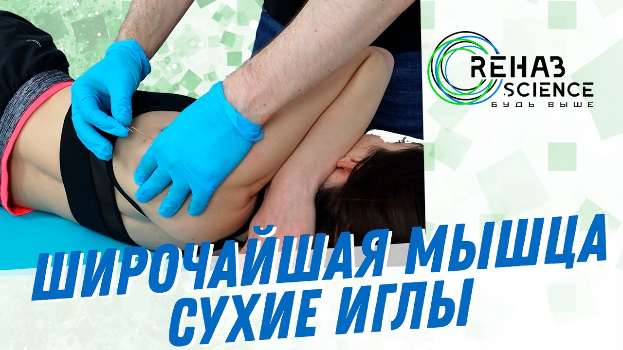 Постановка сусхих игл в позиции на боку. Широчайшая мышца
