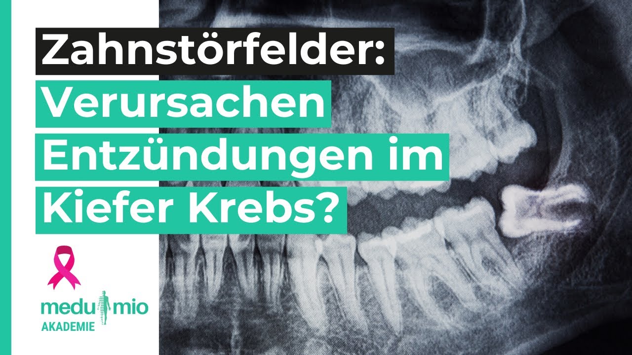 NICO & RANTES: Entzündungen im Kiefer als Ursache für Krebs? 🦷 Dr. Dr. Johann Lechner