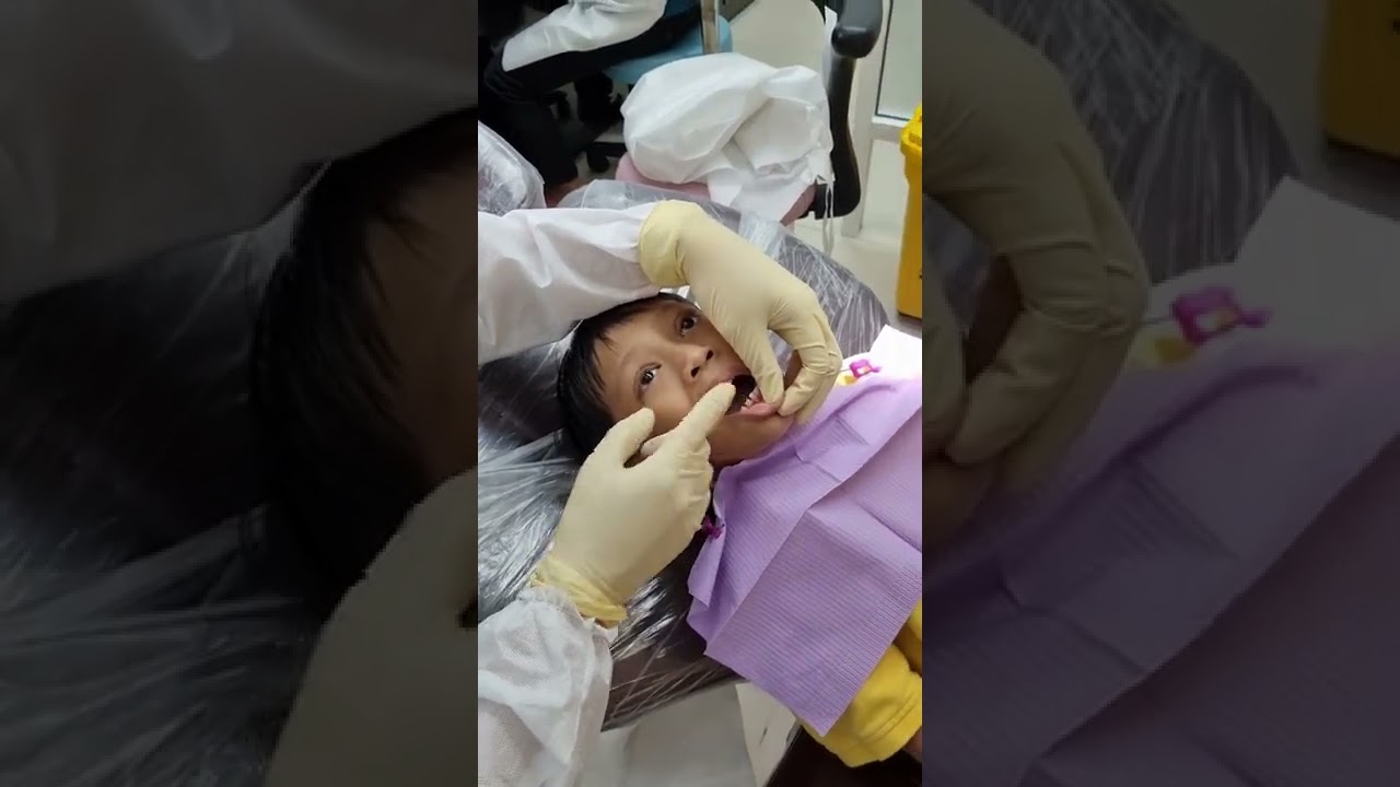 Adakah Gigi Susu Perlu Dicabut Bila Gigi Kekal Tumbuh