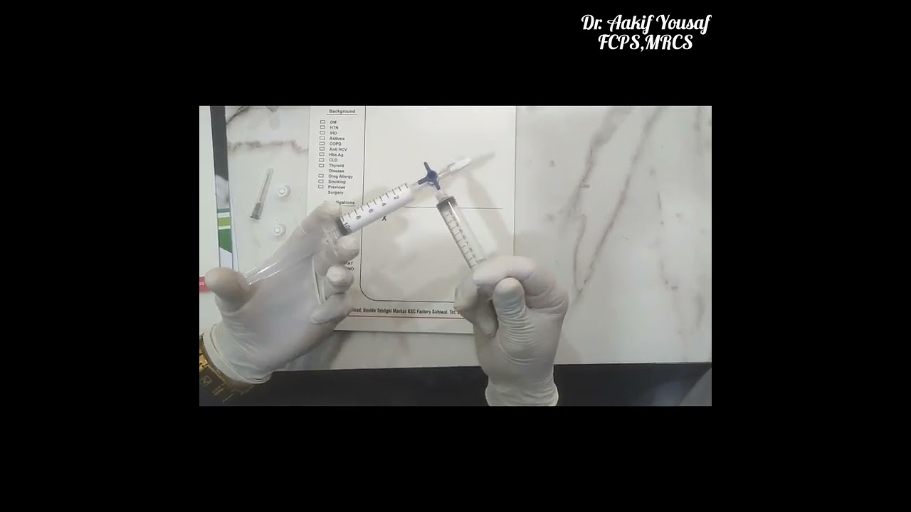How to make foam for Sclerotherapy ( Tessari Method)