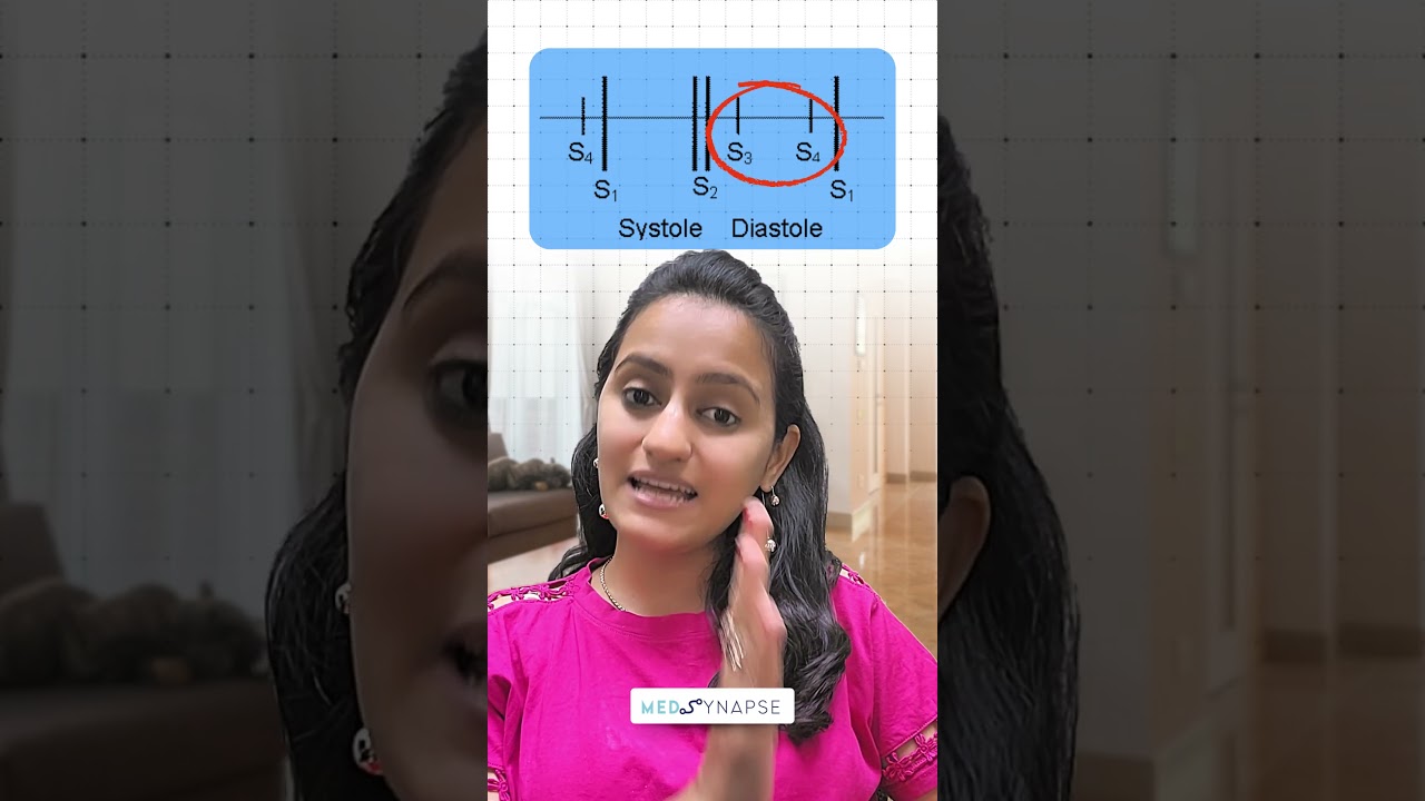 Learn a quick trick to remember heart sounds effortlessly! #neetpgpreparation  #fmgeians