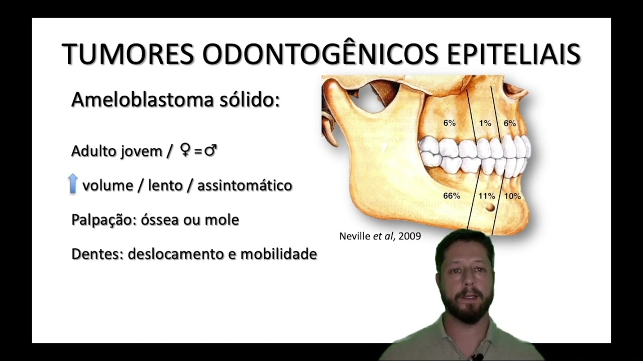 Tumores odontogênicos epiteliais