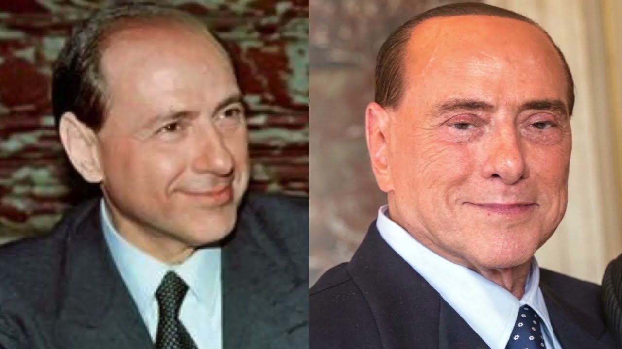 How Silvio Berlusconi changed through Plastic Surgery | Dr. Alawi