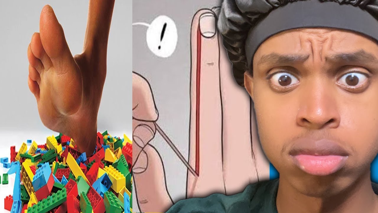 The MOST ANNOYING Types Of Pain We All Experience..