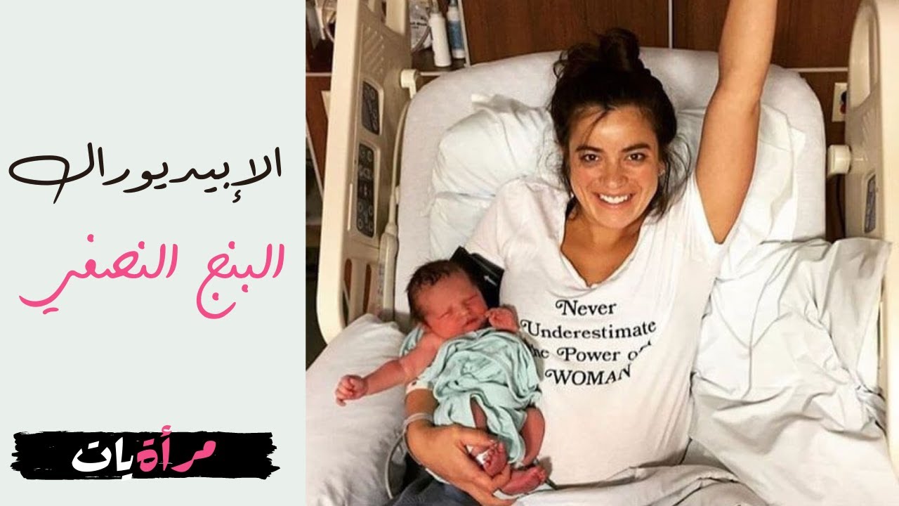 الولادة بدون ألم