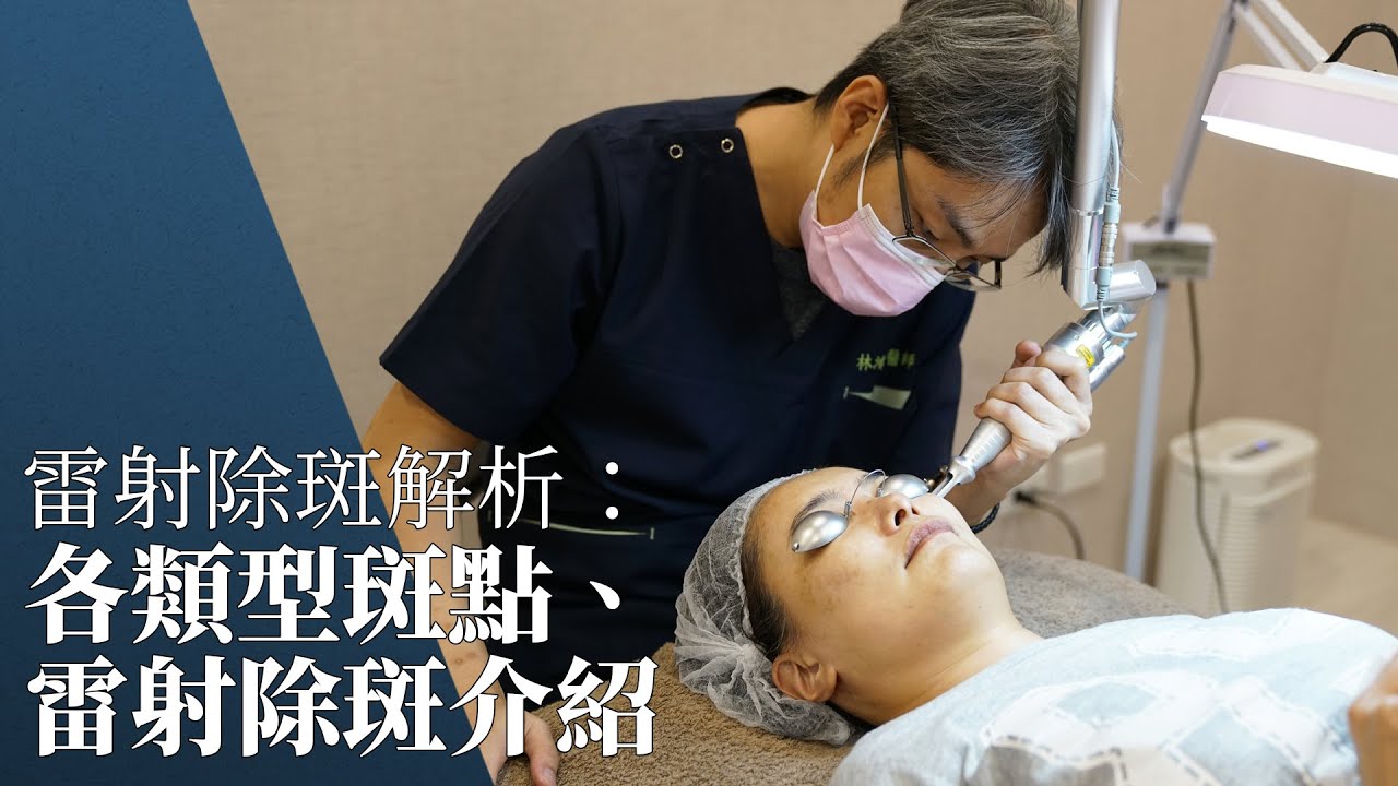 雷射除斑解析：各類型斑點、雷射除斑介紹｜W頂尖醫美