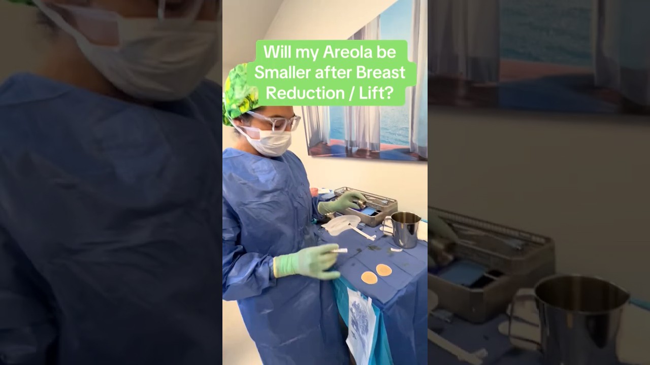 Areola size after breast reduction