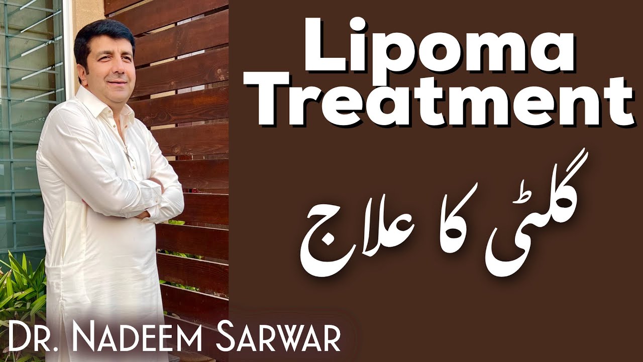 Lipoma Treatment/ Lipoma Ka ilaaj - Homeopathic by H. Dr. M. Nadeem Sarwar ENG subs
