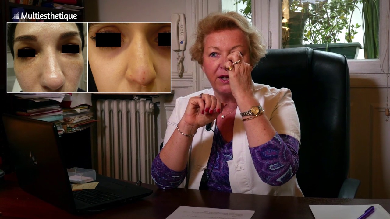 Rhinoplastie médicale