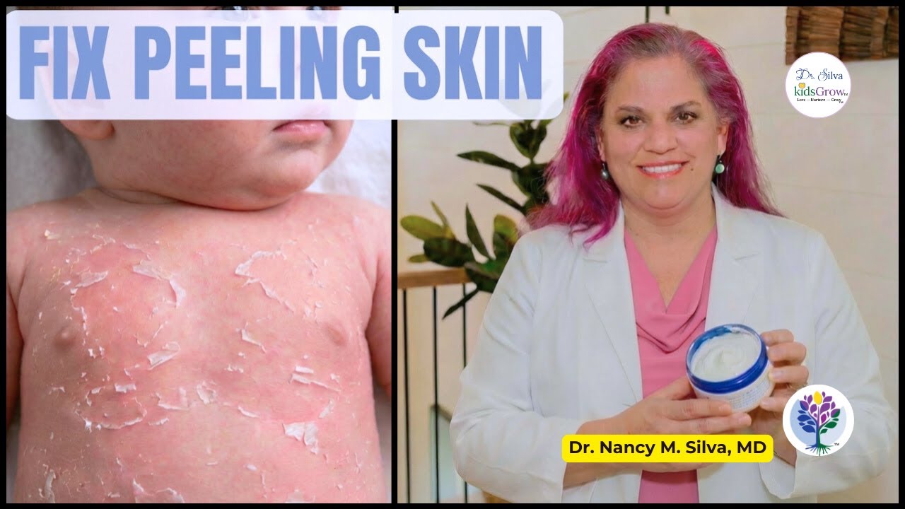 Don't Use Lotion! Best Newborn Skin Care Routine