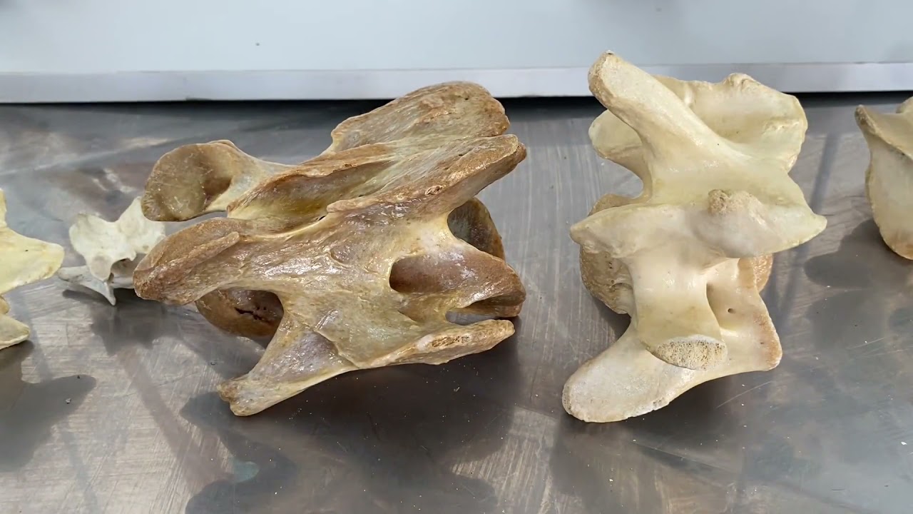 Bir vertebrae'de bulunması gerekenler