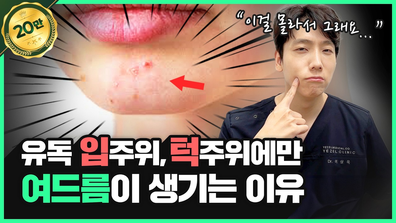 성인 여드름☝🏻 우리가 몰랐던 턱, 입 주변으로만 여드름이 나는 이유와 관리방법