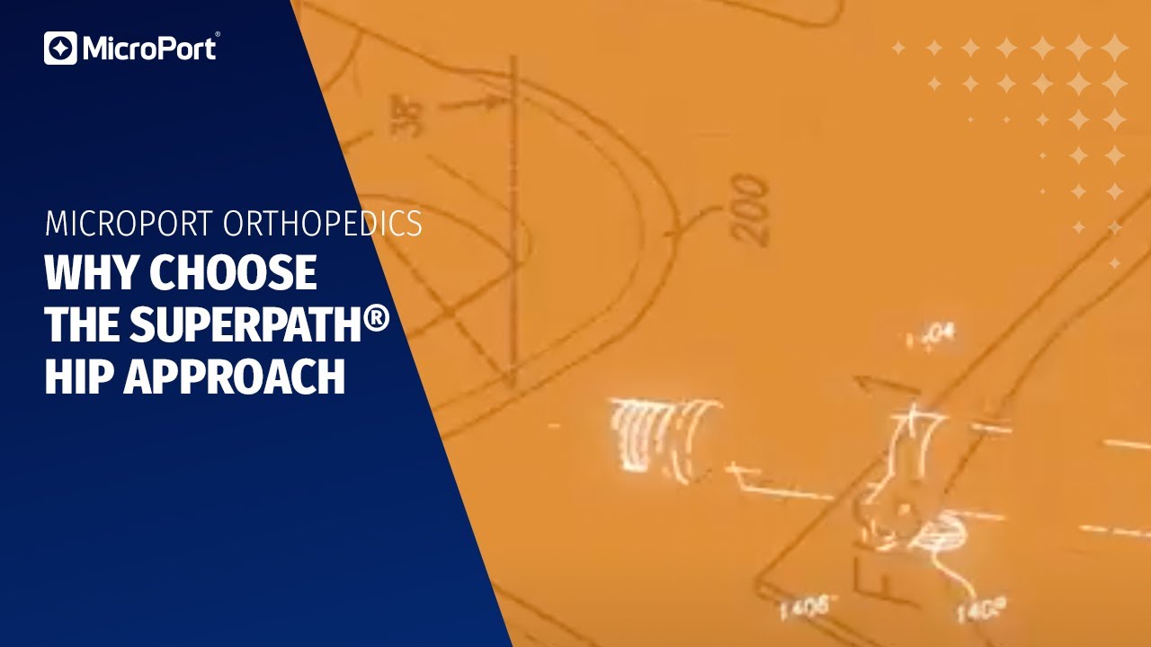 Why Choose the SuperPath® Hip Approach