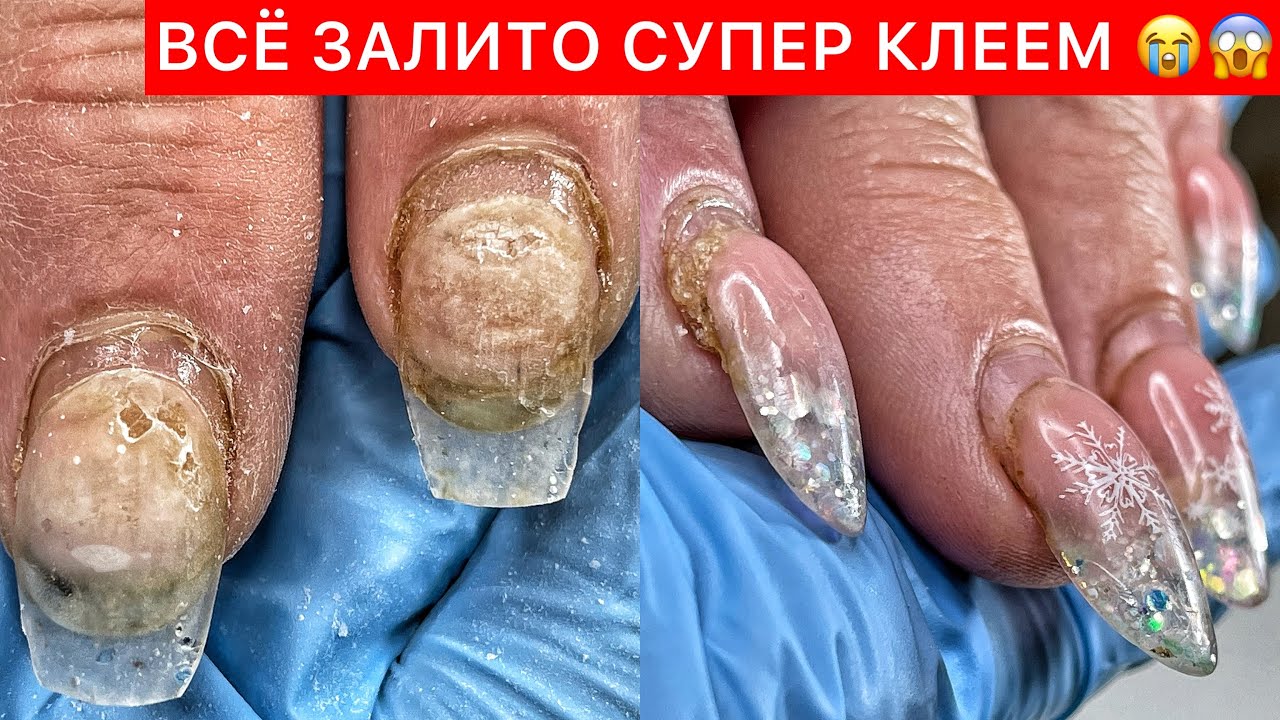 Маникюр уничтожен . И что теперь делать ?