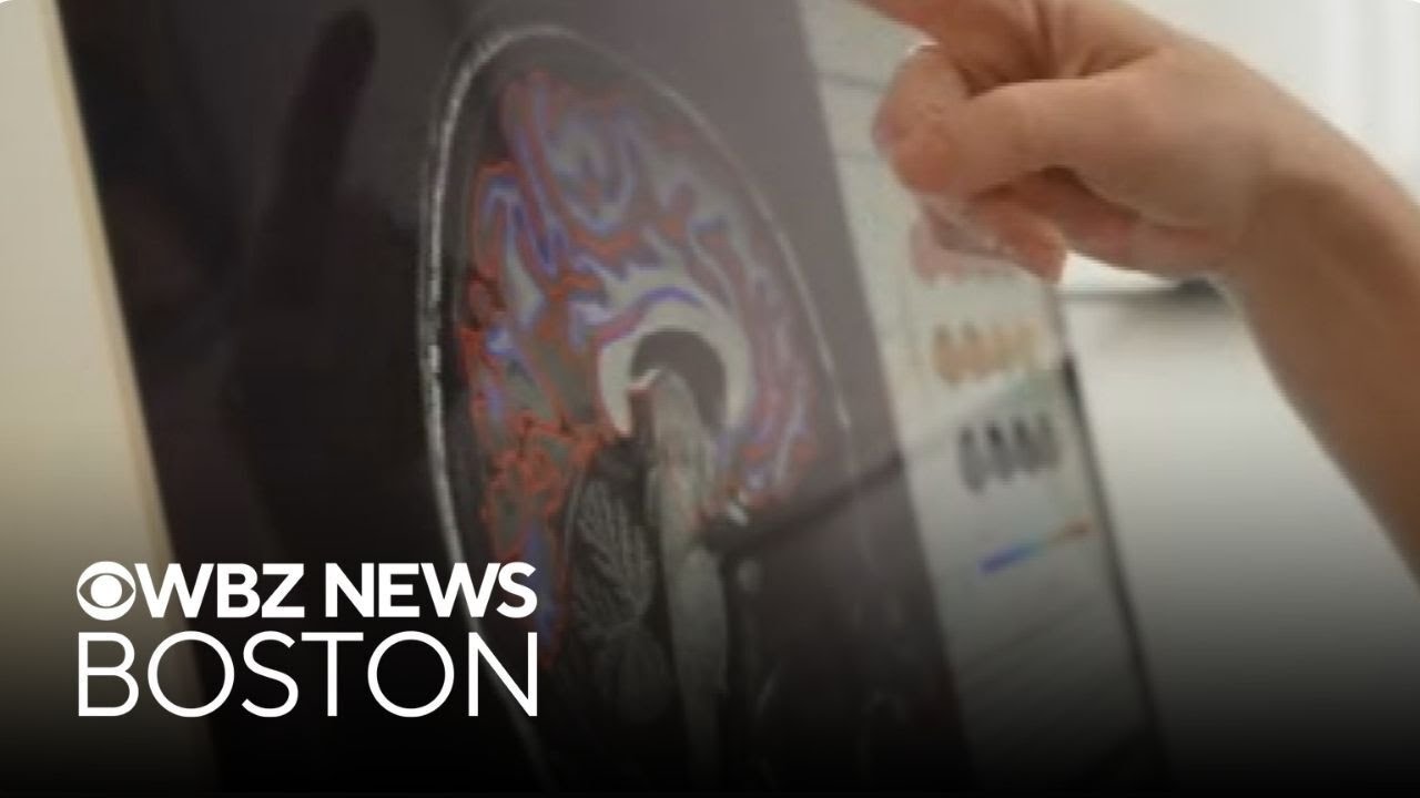 Researchers say that women's brains are transformed by pregnancy