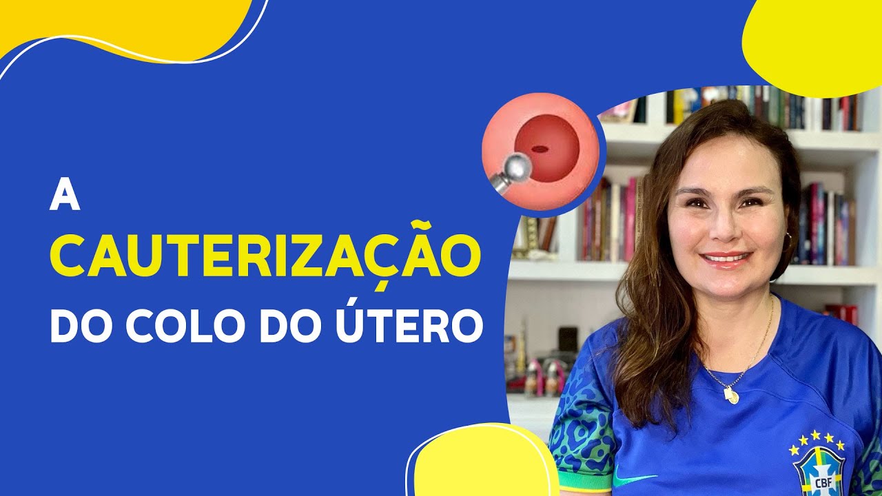 CAUTERIZAÇÃO do colo uterino.
