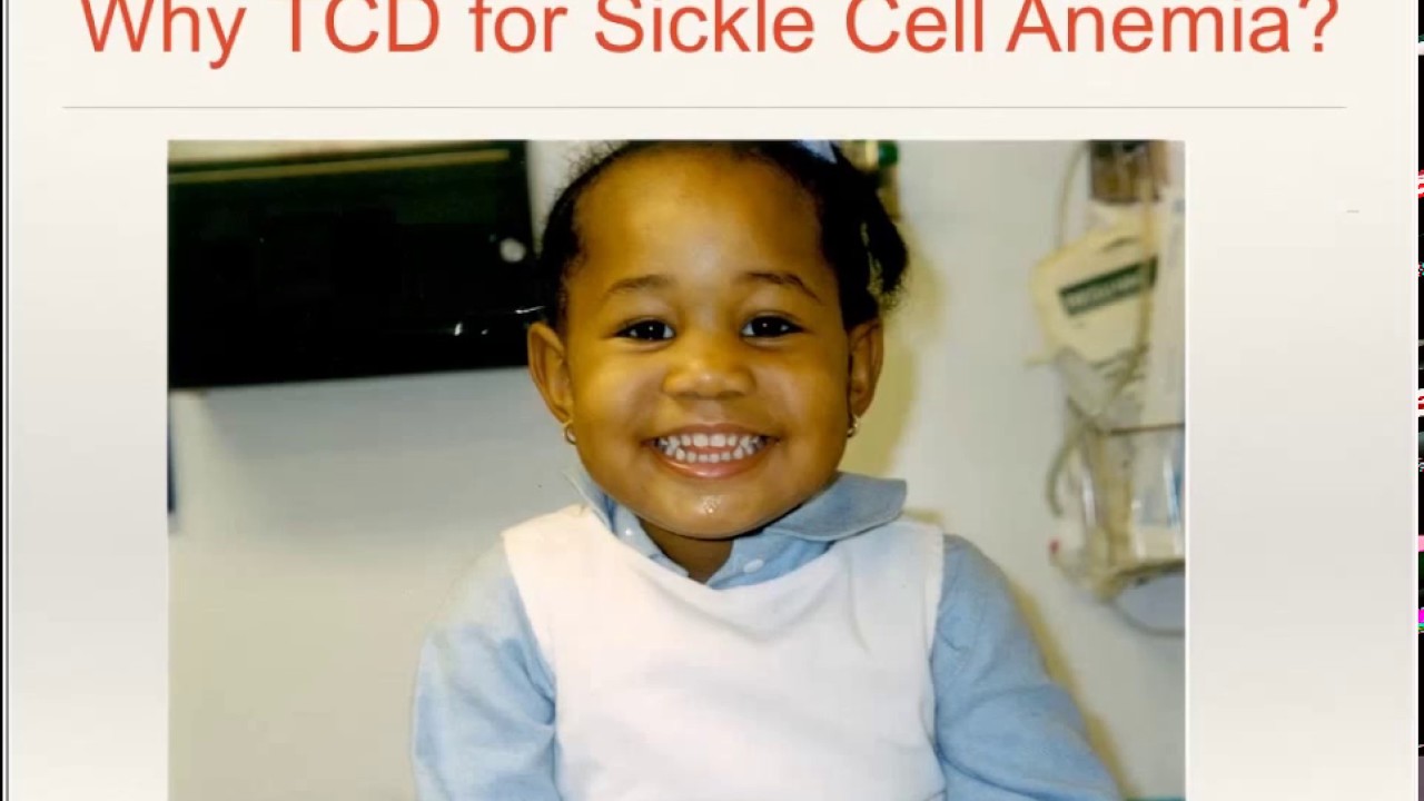 Natus TCD Webinar: TCD Evaluation in Patients with Sickle Cell Disease