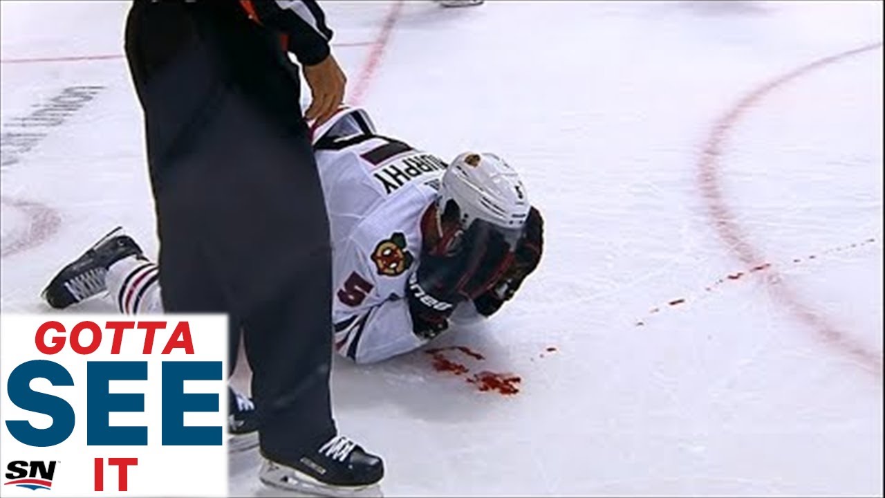 GOTTA SEE IT: Blackhawks' Murphy Bloodied By Pitlick Elbow To Face
