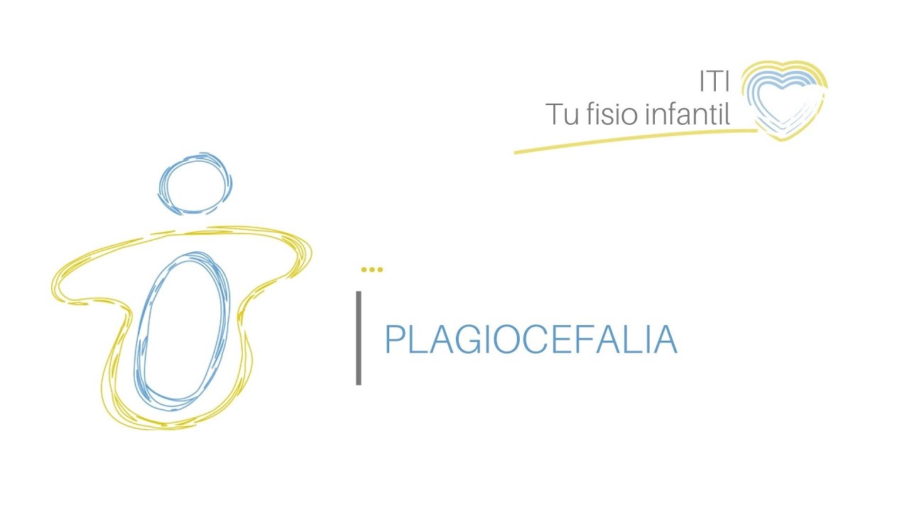 ¿Tu hijo presenta un aplanamiento en la parte posterior de la cabeza?