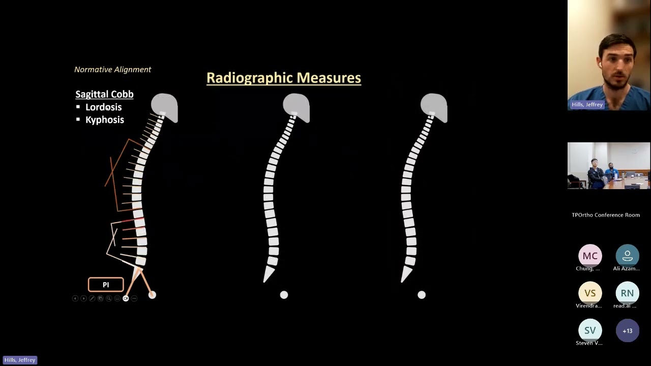 T4-L1 Hip Axis: Toward Precision Alignment Targets : Jeffrey Hills, MD