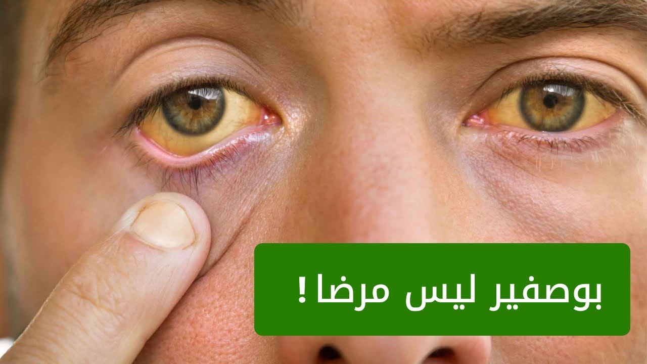 من أين يأتي بوصفير وما هي أسبابه الحقيقية ؟!