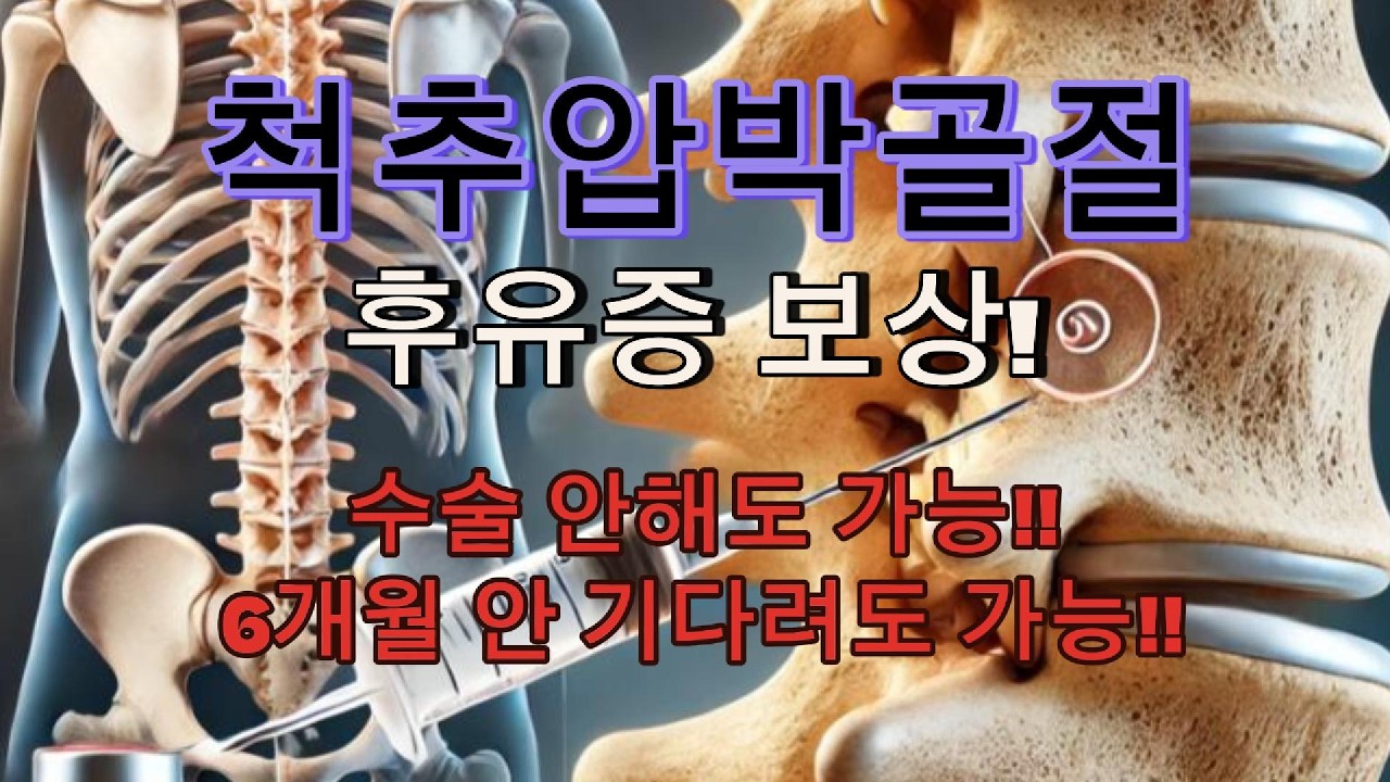 척추압박골절, 수술 안 했어도 '후유증 보상' 꼭 챙기세요(후유장해보험금 핵심질문 총정리)