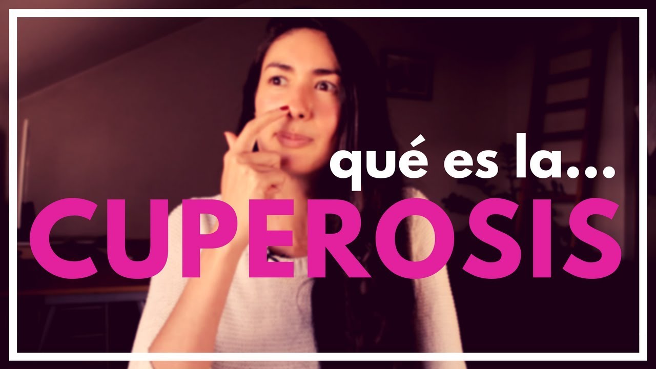 Qué es la CUPEROSIS y cómo puedes combatirla