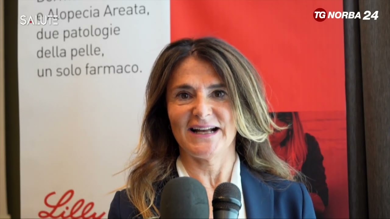 Baricitinib nuova terapia per Alopecia areata e Dermatite Atopica