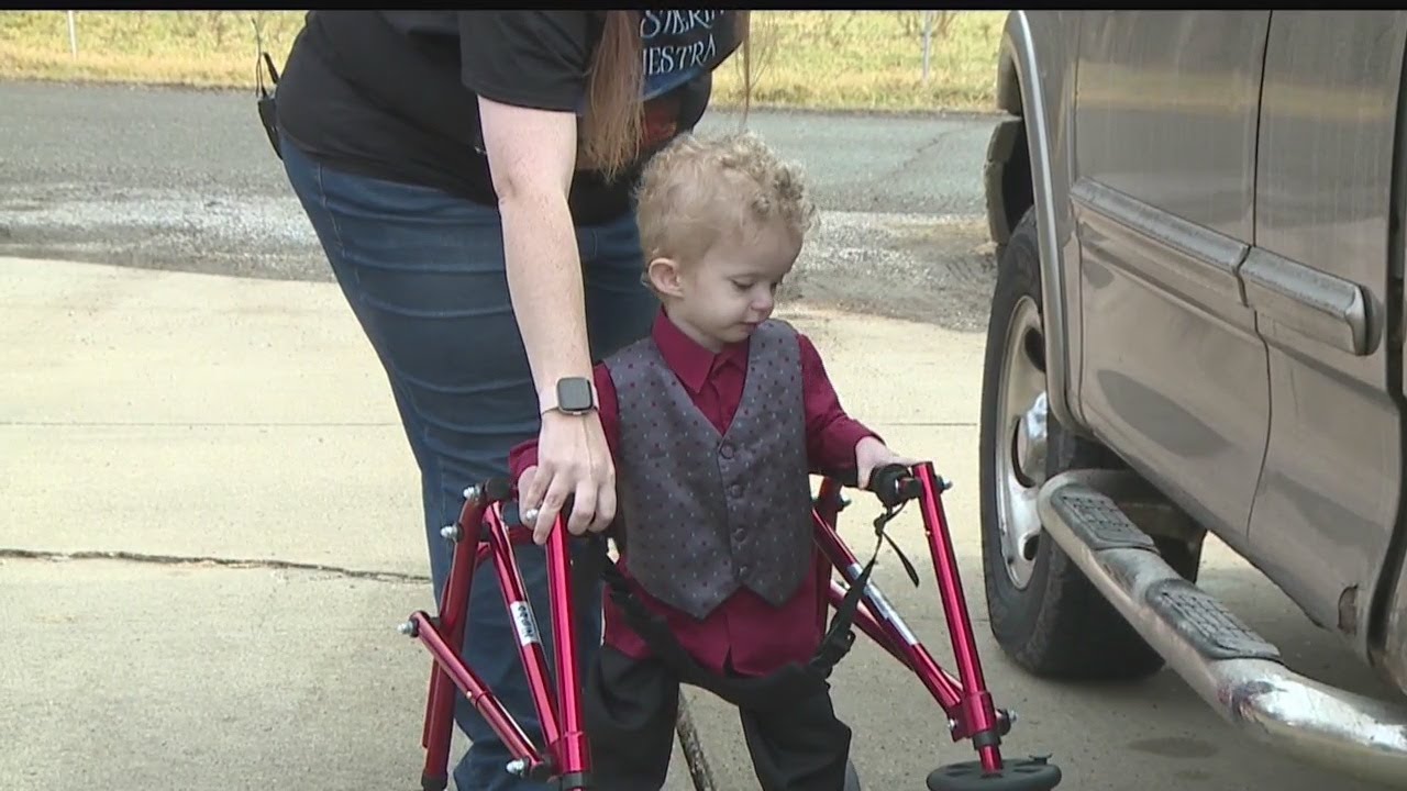 Girard toddler is living with Dandy Walker Syndrome