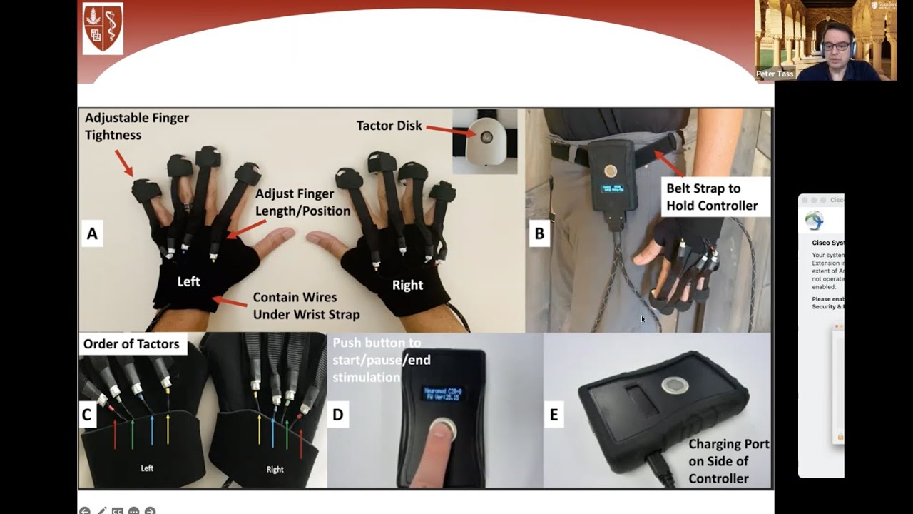 A Glove To Treat Parkinson’s Disease?
