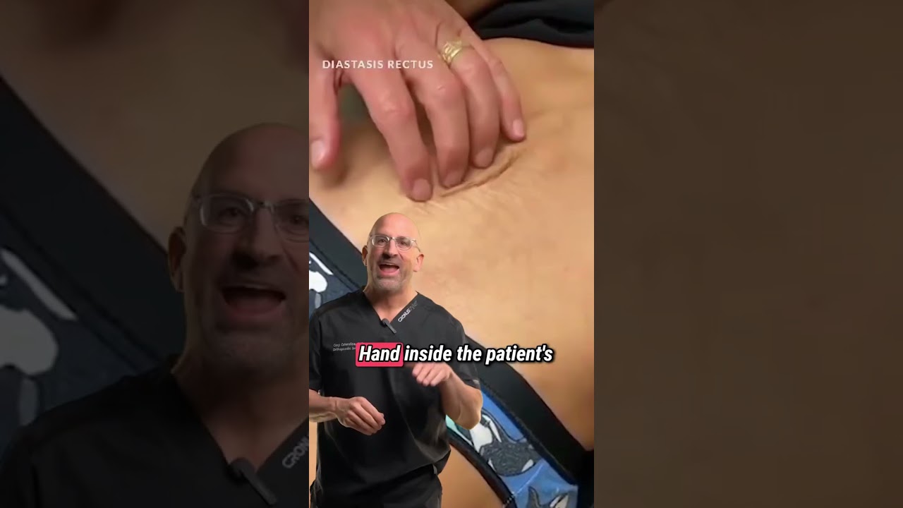 Hand Inside Abdomen? Diastasis Recti #shorts