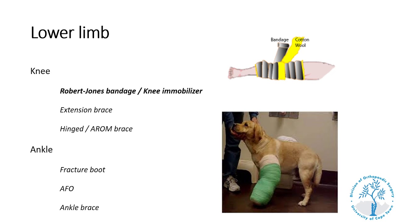 Maritz Laubscher- Splints & traction in orthopaedics