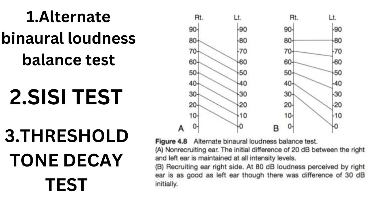 Recruitment Phenomenon , SISI Test , Threshold Tone Decay Test | Special Tests Of Hearing