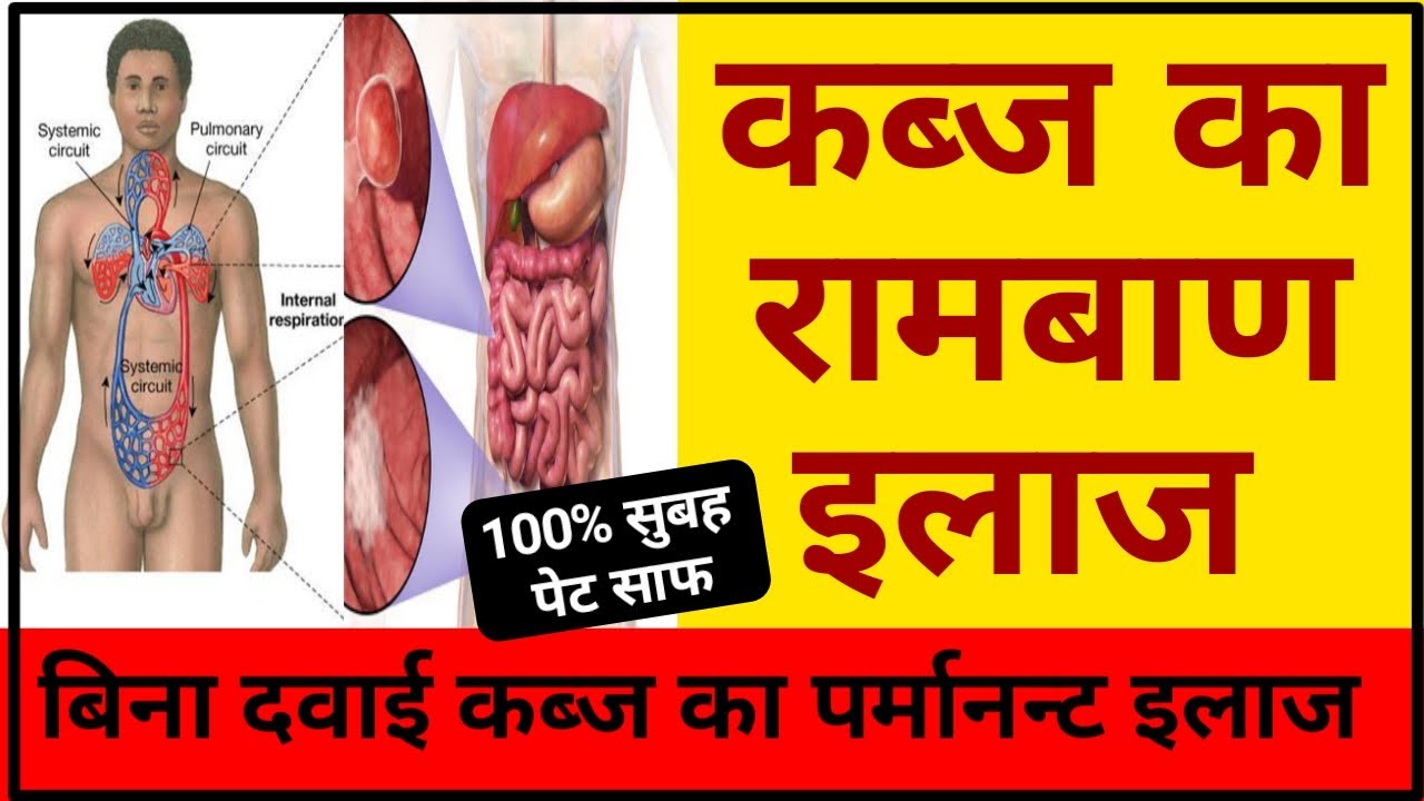 Kabj ka ilaj in hindi, कब्ज का इलाज, कब्ज की दवा | Cure Constipation Permanently, Kabj Ka Ilaj