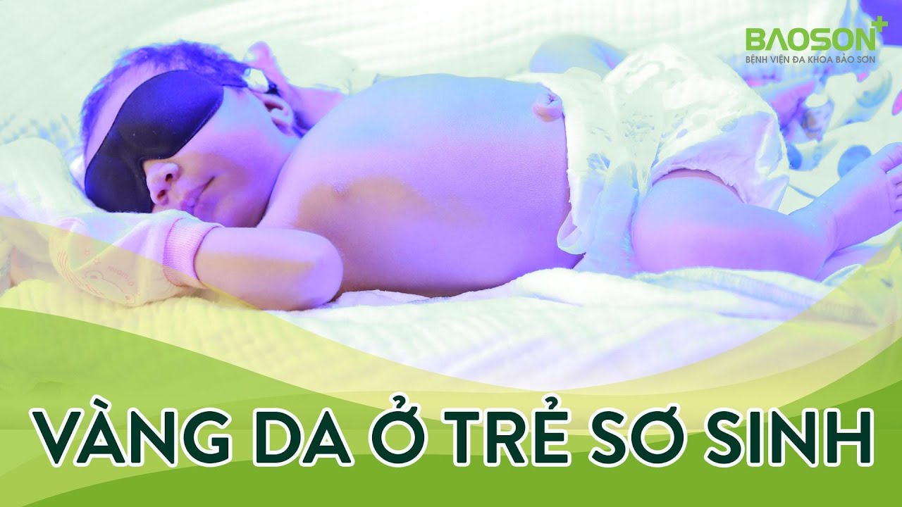 Cách nhận biết vàng da ở trẻ sơ sinh | Bệnh viện Đa khoa Bảo Sơn