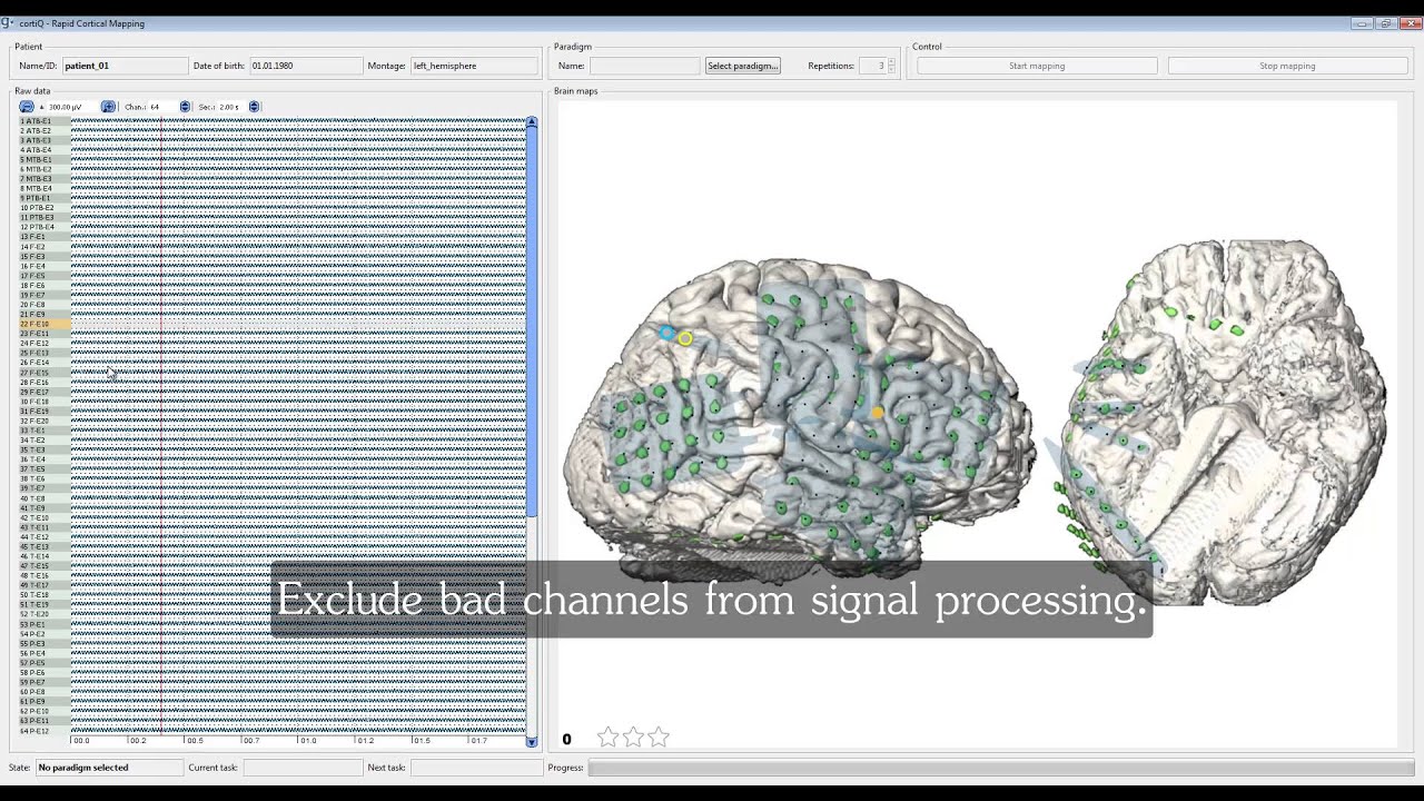 cortiQ - rapid cortical mapping