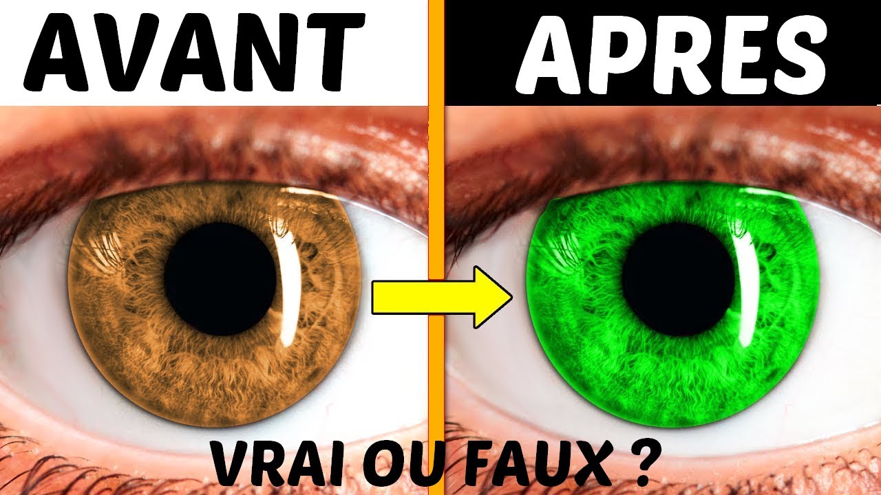 Peut-on Vraiment Changer La Couleur de Ses Yeux ?