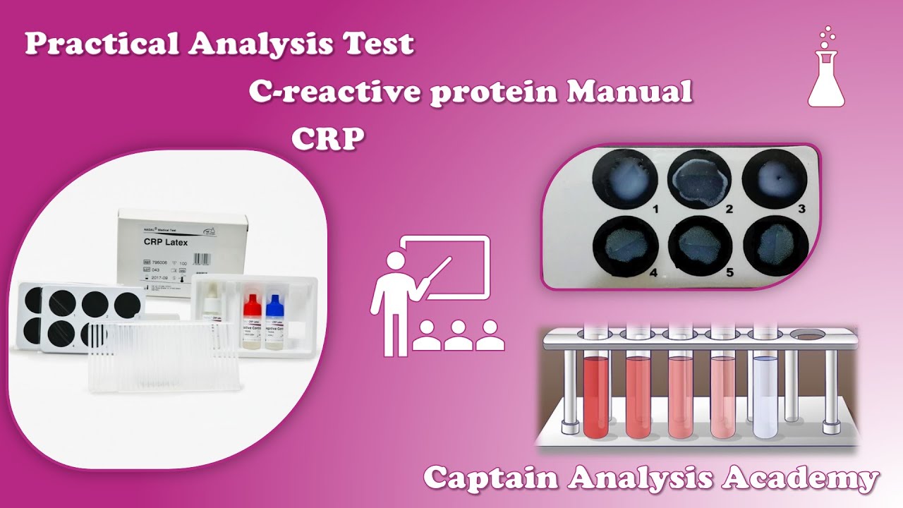 E12. Practical CRP (Latex) Semi-quantitative كل ما يخص تحليل CRP  عملى داخل المعمل +التخفيفات
