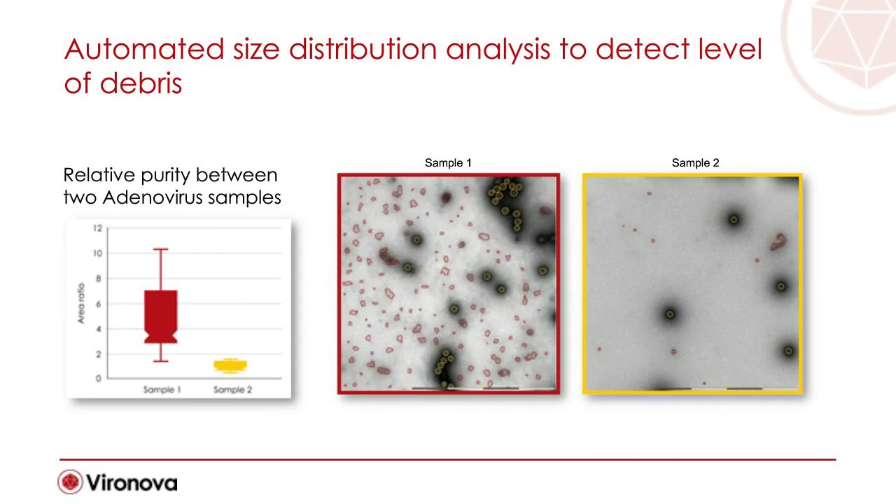 Automated Purity and Integrity Check of Gene Therapy Vectors