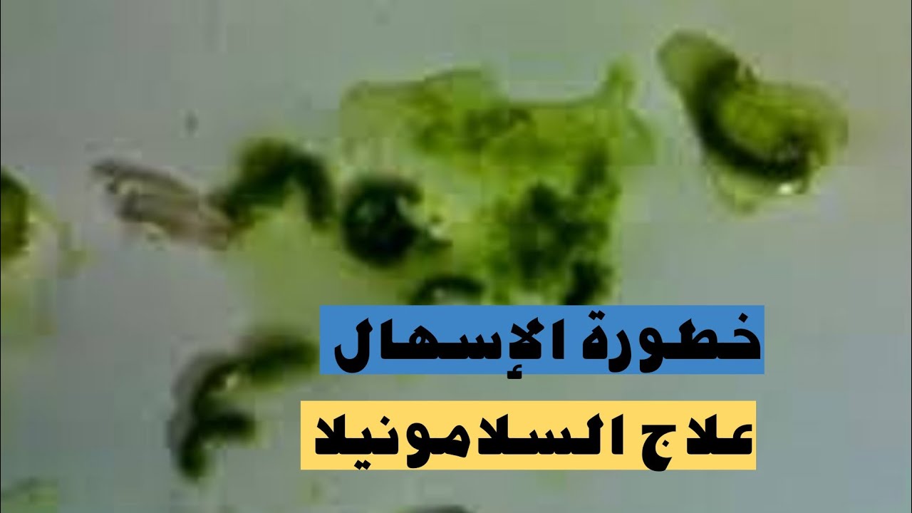 طريقتي في علاج مرض السلامونيلا وايقاف الاسهال المستمر