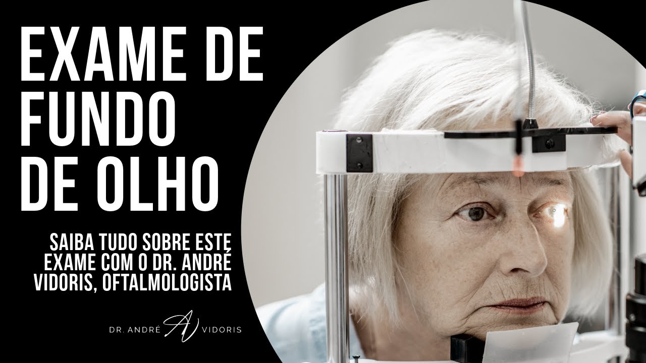 Tudo sobre exame de fundo de olho com o oftalmologista Dr. André Vidoris.