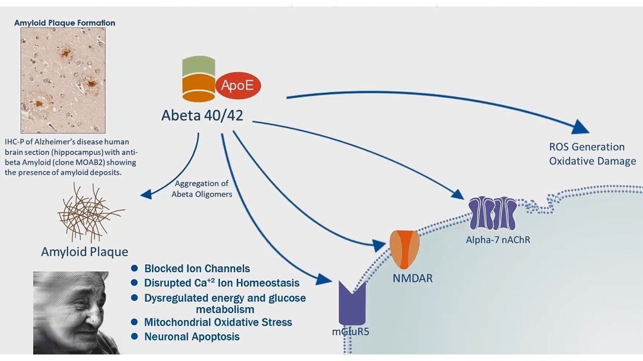 Alzheimer's Disease: APP Processing & Amyloid Plaque Formation