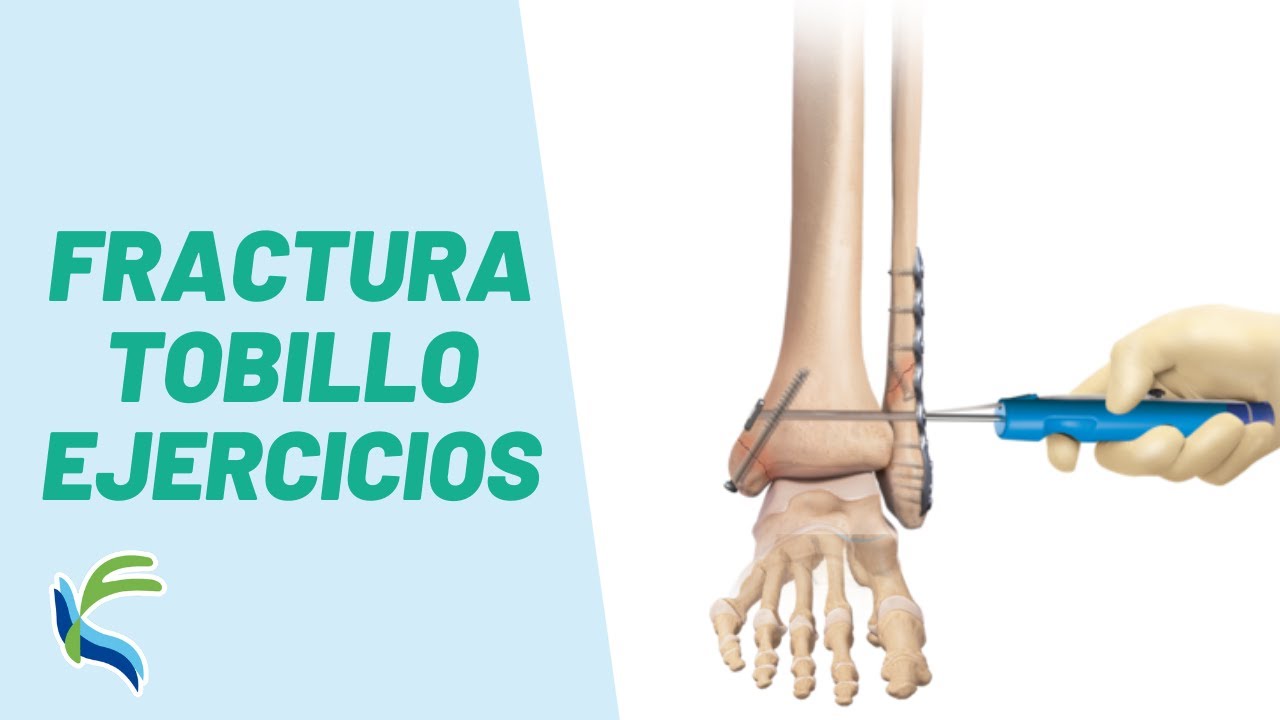 EJERCICIOS para FRACTURA de TOBILLO | Fisiolution