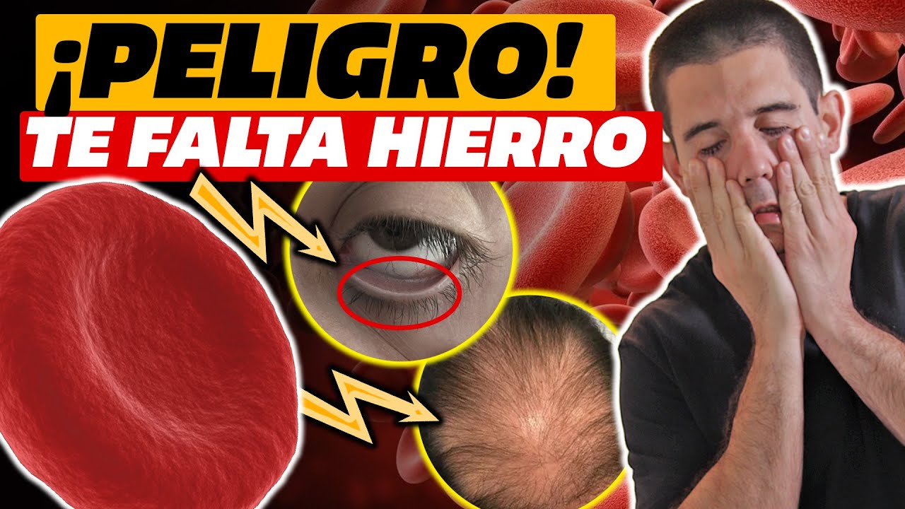 ¡CUIDADO! HIERRO BAJO⚠️Primeros SÍNTOMAS, ELEMENTOS que INHIBEN su ABSORCIÓN y ALIMENTOS a tomar