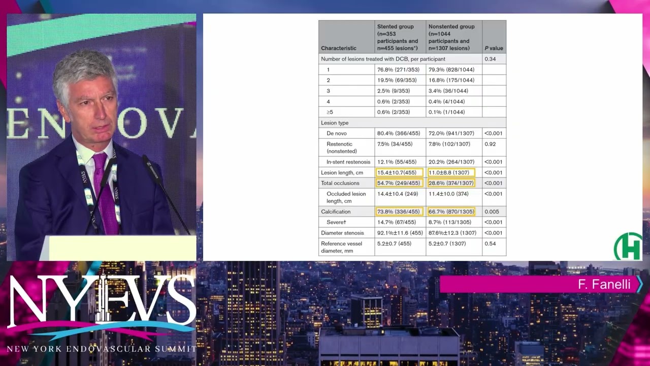 DCB with Spot Stenting is the Right Way to Treat Long Segment SFA Disease  - Prof. Fabrizio Fanelli
