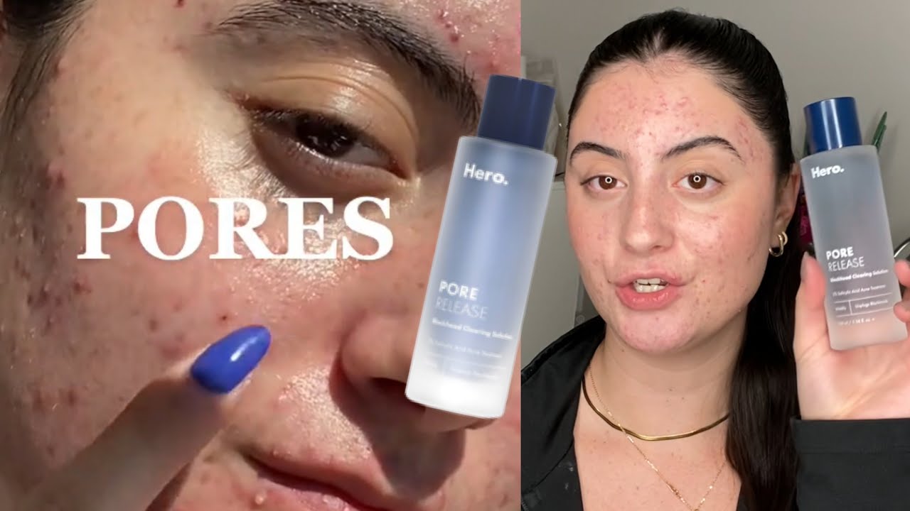 HERO PORE RELEASE 2% РАСТВОР САЛИЦИЛОВОЙ КИСЛОТЫ ОТ АКНЕ И ЧЕРНЫХ ТОЧЕК