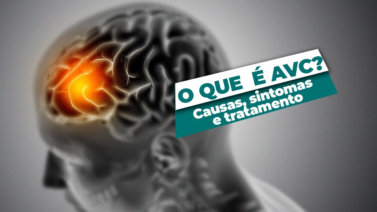 O que  é AVC? Causas, sintomas e tratamento